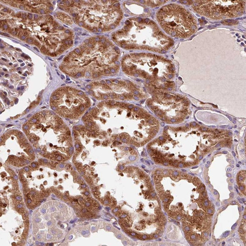 Immunohistochemical staining of human kidney shows strong cytoplasmic positivity in cells in tubules.