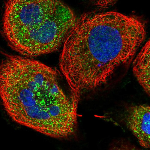 Immunofluorescent staining of human cell line A-431 shows localization to cytosol & vesicles.