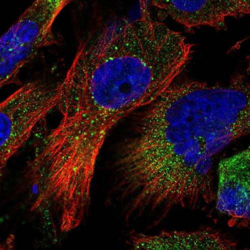 Immunofluorescent staining of human cell line U-251 MG shows localization to cytosol & vesicles.