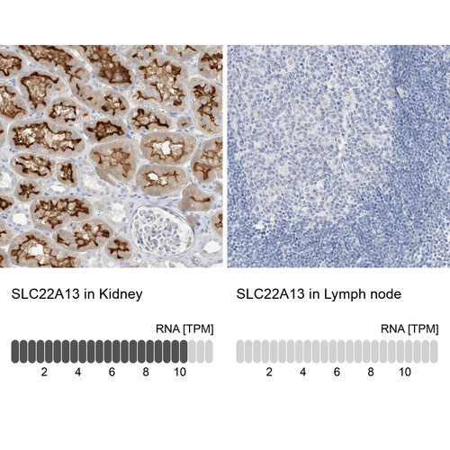 Immunohistochemistry analysis in human kidney and lymph node tissues using Anti-SLC22A13 antibody. Corresponding SLC22A13 RNA-seq data are presented for the same tissues.