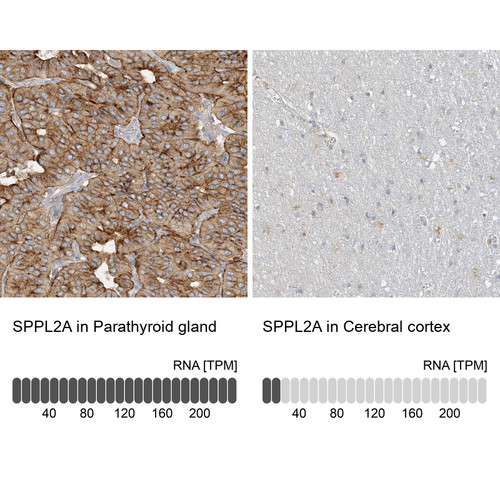 Immunohistochemistry analysis in human parathyroid gland and cerebral cortex tissues using HPA036062 antibody. Corresponding SPPL2A RNA-seq data are presented for the same tissues.