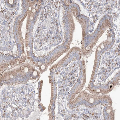 Immunohistochemical staining of human duodenum shows moderate cytoplasmic positivity in glandular cells.