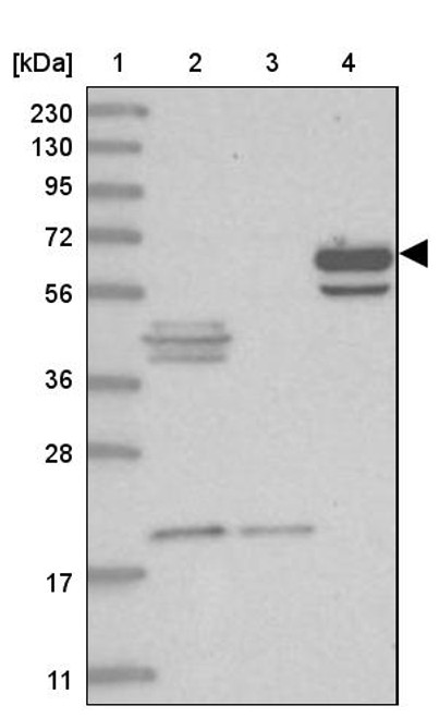 Lane 1: Marker [kDa] 230, 130, 95, 72, 56, 36, 28, 17, 11<br/>Lane 2: Human cell line RT-4<br/>Lane 3: Human cell line U-251MG sp<br/>Lane 4: Human plasma (IgG/HSA depleted)