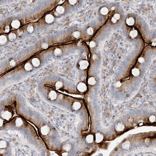 Immunohistochemical staining of human duodenum shows strong cytoplasmic and membranous positivity in glandular cells.