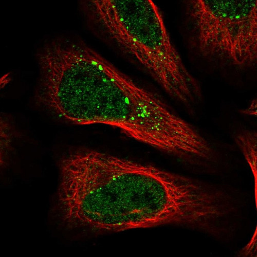 Immunofluorescent staining of human cell line U-2 OS shows localization to nucleoplasm & vesicles.