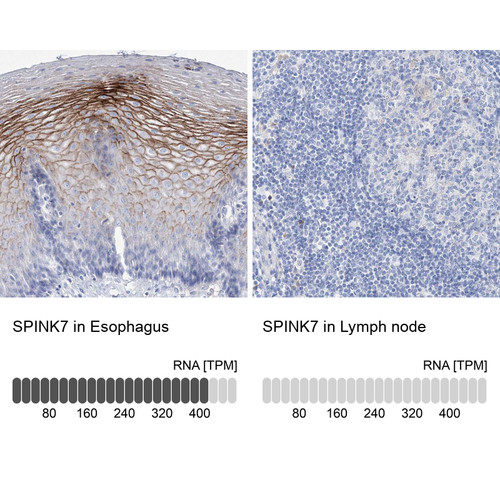 Immunohistochemistry analysis in human esophagus and lymph node tissues using Anti-SPINK7 antibody. Corresponding SPINK7 RNA-seq data are presented for the same tissues.