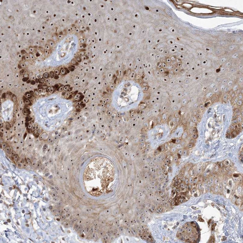 Immunohistochemical staining of human skin shows strong nucleolar positivity in epidermal cells.