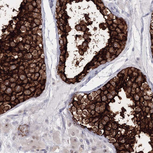 Immunohistochemical staining of human testis shows strong cytoplasmic and membranous positivity in cells in seminiferus ducts. Immunohistochemical staining of human testis shows strong cytoplasmic and membranous positivity in cells in seminiferus ducts.