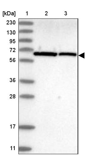 Lane 1: Marker [kDa] 230, 130, 95, 72, 56, 36, 28, 17, 11<br/>Lane 2: Human cell line RT-4<br/>Lane 3: Human cell line U-251MG sp