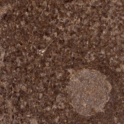 Immunohistochemical staining of human tonsil shows strong cytoplasmic and nuclear positivity.
