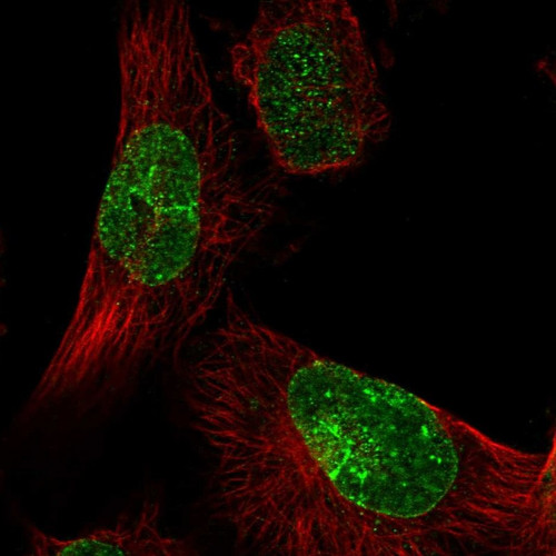 Immunofluorescent staining of human cell line U-251 MG shows localization to nuclear membrane.