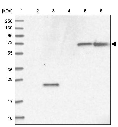 Lane 1: Marker [kDa] 250, 130, 95, 72, 55, 36, 28, 17, 10<br/>Lane 2: Human cell line RT-4<br/>Lane 3: Human cell line U-251MG sp<br/>Lane 4: Human plasma (IgG/HSA depleted)<br/>Lane 5: Human liver tissue<br/>Lane 6: Human tonsil tissue