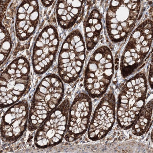 Immunohistochemical staining of human colon shows strong cytoplasmic and membrane positivity in glandular cells.
