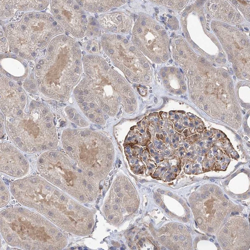 Immunohistochemical staining of human kidney shows cytoplasmic positivity in cells in tubules and cells in glomeruli.