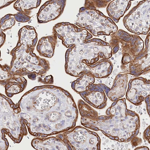 Immunohistochemical staining of human thyroid gland shows moderate membranous positivity in glandular cells.