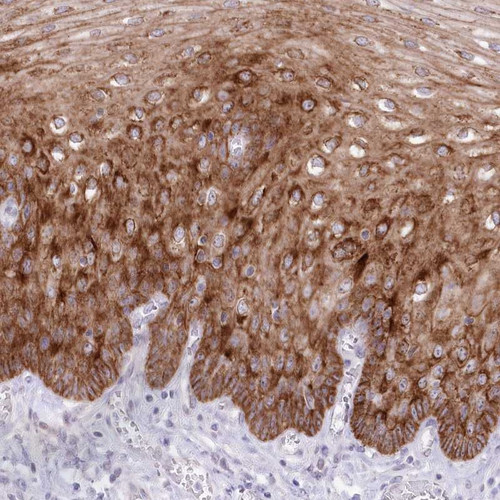 Immunohistochemical staining of human esophagus shows strong cytoplasmic positivity in squamous epithelial cells.