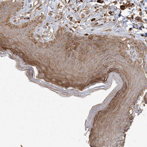 Immunohistochemical staining of human skin shows moderate cytoplasmic positivity in squamous epithelial cells.