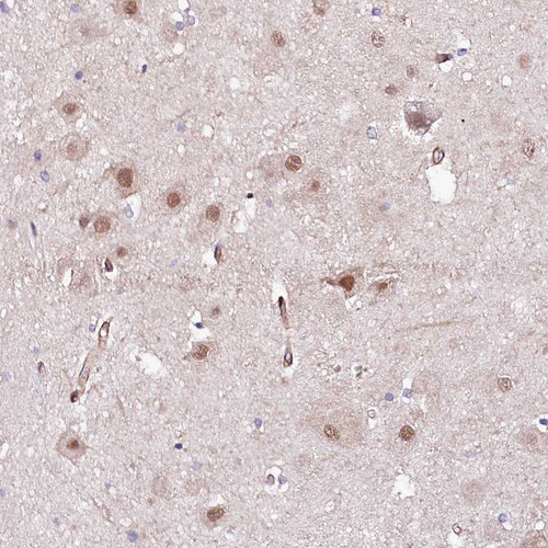 Immunohistochemical staining of human hippocampus shows moderate nuclear positivity in neurons.