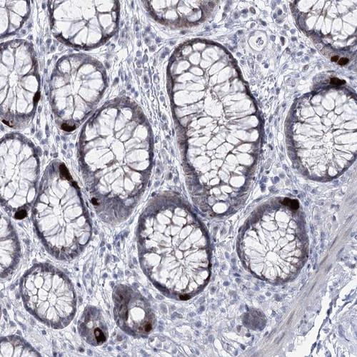 Immunohistochemical staining of human rectum shows strong cytoplasmic positivity in endocrine cells.