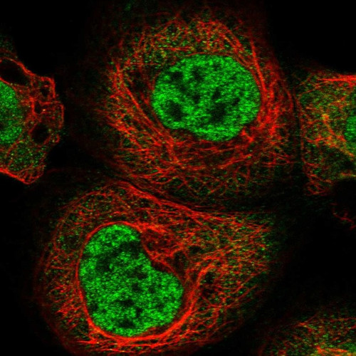 Immunofluorescent staining of human cell line A-431 shows localization to nucleoplasm.