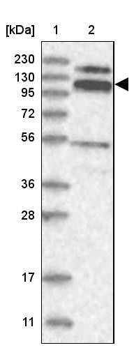 Lane 1: Marker [kDa] 230, 130, 95, 72, 56, 36, 28, 17, 11<br/>Lane 2: Human cell line RT-4