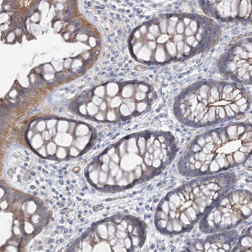 Immunohistochemical staining of human colon shows moderate cytoplasmic and membranous positivity in glandular cells.