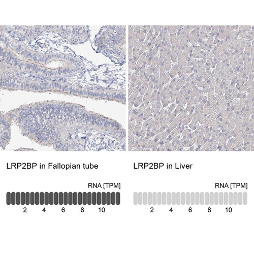 Immunohistochemistry analysis in human fallopian tube and liver tissues using HPA036664 antibody. Corresponding LRP2BP RNA-seq data are presented for the same tissues.