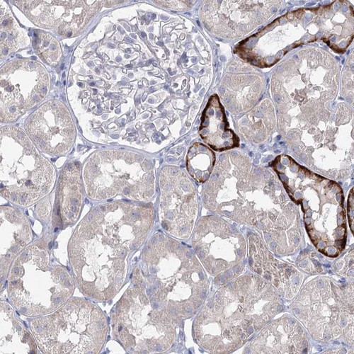 Immunohistochemical staining of human kidney shows strong cytoplasmic positivity in a subset of cells in tubules.