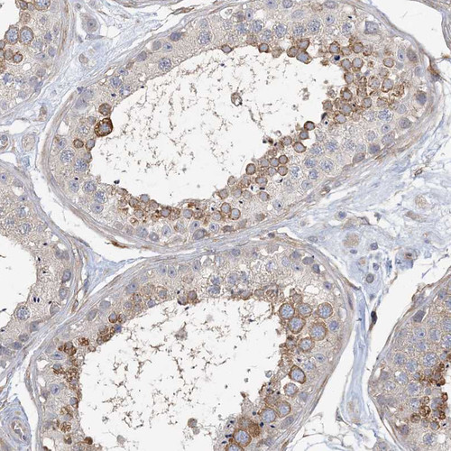 Immunohistochemical staining of human testis shows moderate cytoplasmic positivity in cells in seminiferous ducts.