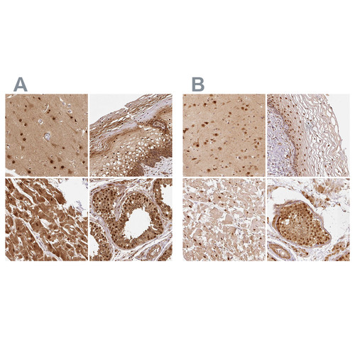 Immunohistochemical staining of human cerebral cortex, cervix, uterine, heart muscle and testis using Anti-PSMD1 antibody HPA036737 (A) shows similar protein distribution across tissues to independent antibody HPA036736 (B).