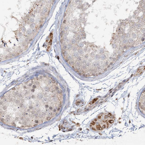 Immunohistochemical staining of human testis shows moderate cytoplasmic positivity in Leydig cells.