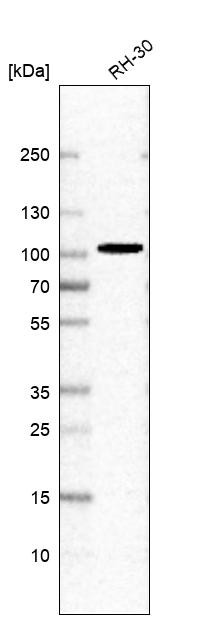 Western blot analysis in human cell line RH-30.