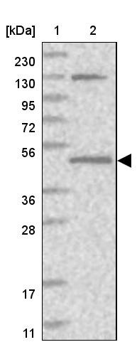 Lane 1: Marker [kDa] 230, 130, 95, 72, 56, 36, 28, 17, 11<br/>Lane 2: Human cell line RT-4