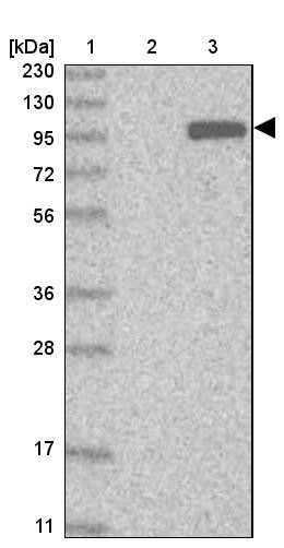 Lane 1: Marker [kDa] 230, 130, 95, 72, 56, 36, 28, 17, 11<br/>Lane 2: Human cell line RT-4<br/>Lane 3: Human cell line U-251MG sp
