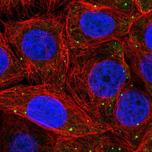 Immunofluorescent staining of human cell line MCF7 shows localization to vesicles.