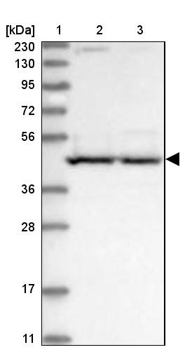 Lane 1: Marker [kDa] 230, 130, 95, 72, 56, 36, 28, 17, 11<br/>Lane 2: Human cell line RT-4<br/>Lane 3: Human cell line U-251MG sp