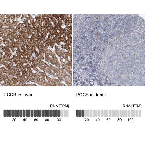 Immunohistochemistry analysis in human liver and tonsil tissues using Anti-PCCB antibody. Corresponding PCCB RNA-seq data are presented for the same tissues.
