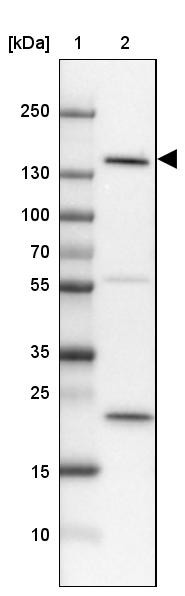 Lane 1: Marker [kDa] 250, 130, 100, 70, 55, 35, 25, 15, 10<br/>Lane 2: Human Cerebral Cortex tissue