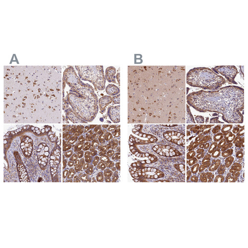 Immunohistochemical staining of human cerebral cortex, placenta, rectum and stomach using Anti-QARS antibody HPA036986 (A) shows similar protein distribution across tissues to independent antibody HPA036987 (B).