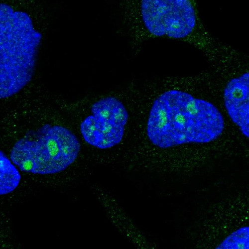 Immunofluorescent staining of human cell line A-431 shows positivity in nucleoli.