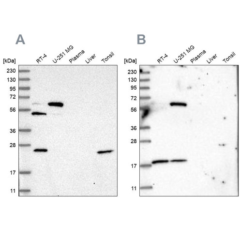 Western blot analysis using Anti-PYROXD2 antibody HPA037566 (A) shows similar pattern to independent antibody HPA037567 (B).