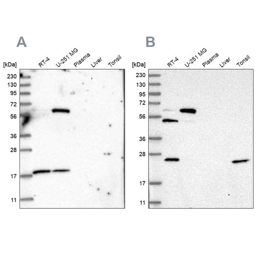 Western blot analysis using Anti-PYROXD2 antibody HPA037567 (A) shows similar pattern to independent antibody HPA037566 (B).