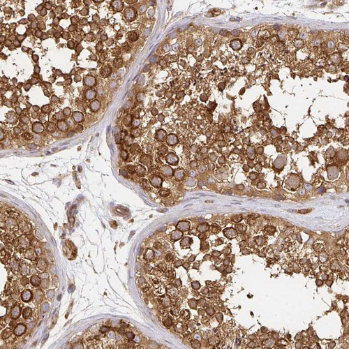 Immunohistochemical staining of human testis shows strong cytoplasmic positivity in cells in seminiferous ducts.