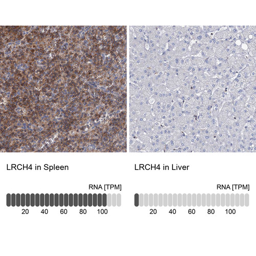 Immunohistochemistry analysis in human spleen and liver tissues using Anti-LRCH4 antibody. Corresponding LRCH4 RNA-seq data are presented for the same tissues.