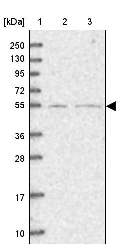Lane 1: Marker [kDa] 250, 130, 95, 72, 55, 36, 28, 17, 10<br/>Lane 2: Human cell line RT-4<br/>Lane 3: Human cell line U-251MG sp