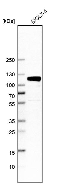Western blot analysis in human cell line MOLT-4.