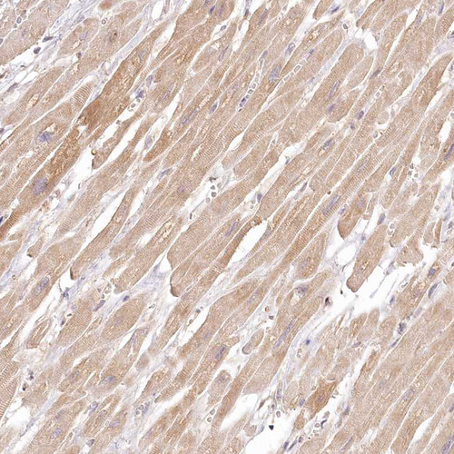 Immunohistochemical staining of human Heart muscle shows moderate cytoplasmic positivity in cardiomyocytes.