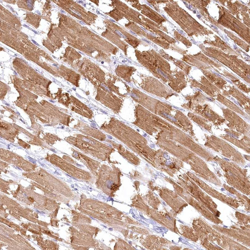 Immunohistochemical staining of human heart muscle shows moderate cytoplasmic positivity in myocytes.