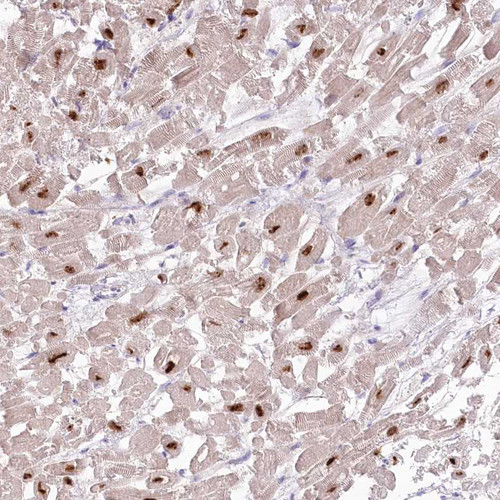 Immunohistochemical staining of human heart muscle shows strong nuclear positivity in cardiomyocytes.