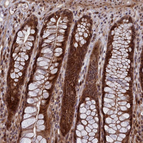Immunohistochemical staining of human rectum shows strong cytoplasmic and nuclear positivity in glandular cells.